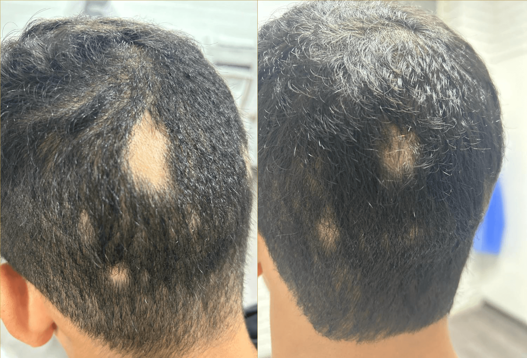 Example of Exosomes effect