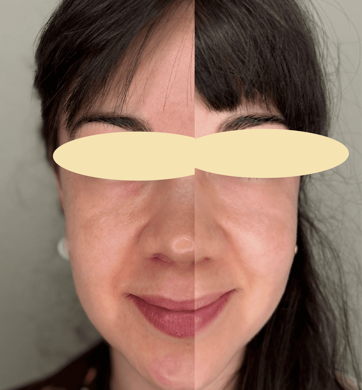 Example of Exosomes effect