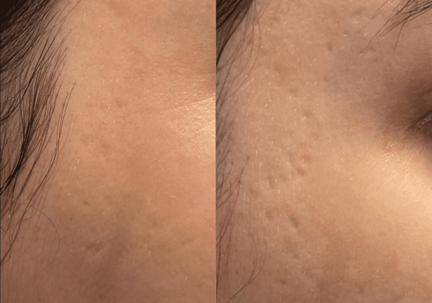 Example of Exosomes effect